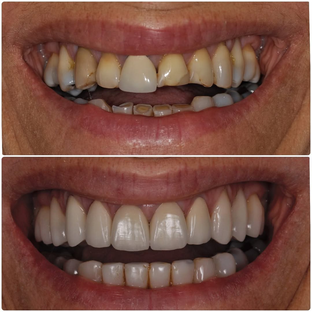 Sorriso renovado após tratamento na Clínica Regalin