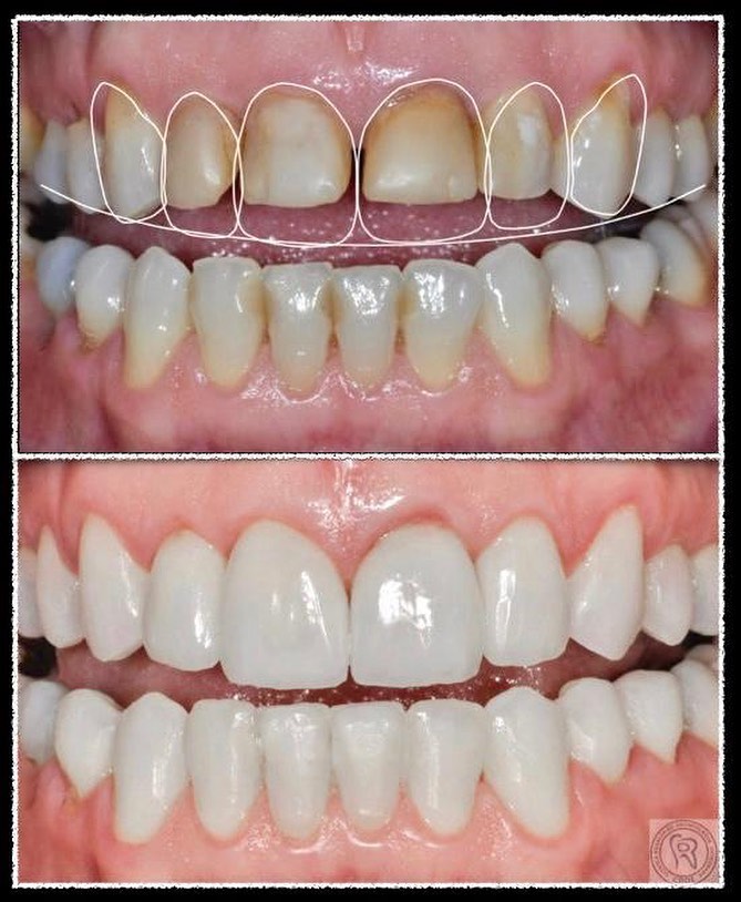 Paciente satisfeito com tratamento na Clínica Regalin