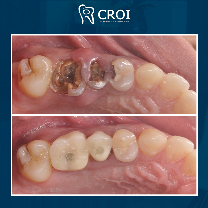 2023-10-03_22-00-06__GraphImage__Cx8-A4bOOjh