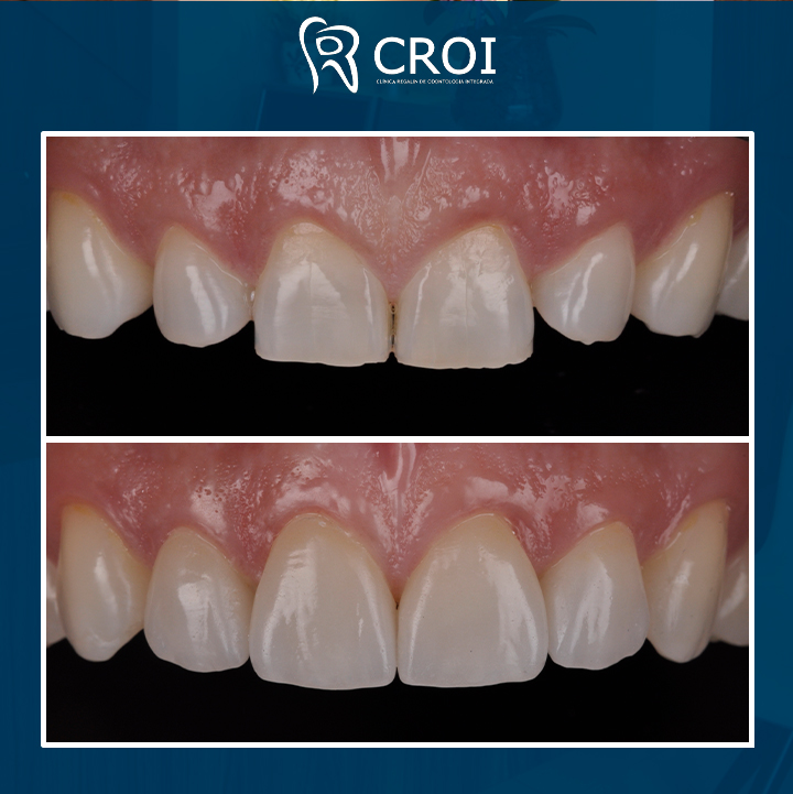 2023-10-10_22-00-07__GraphImage__CyO_lF8PYpf