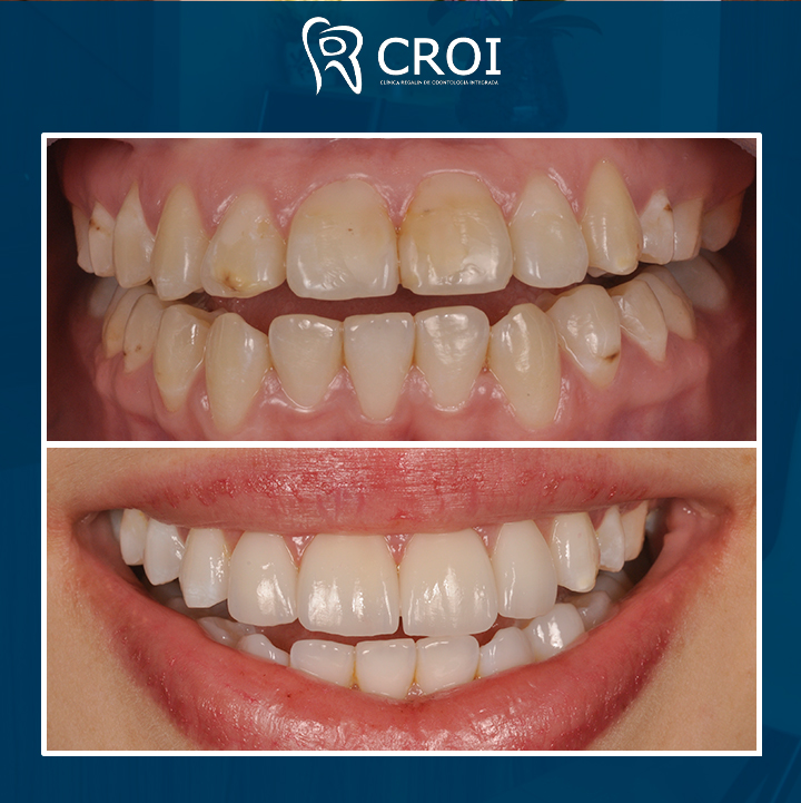 2023-10-17_22-00-08__GraphImage__CyhBJXoBOkL