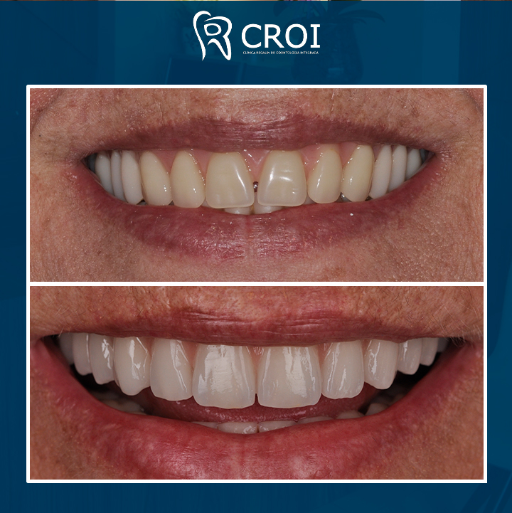 2023-11-09_23-00-24__GraphImage__CzcWU1tPKE9