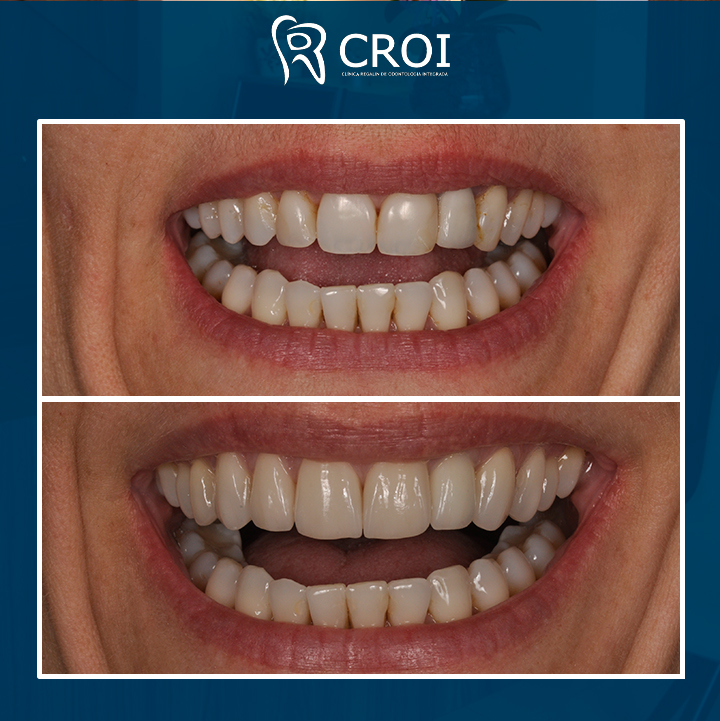 2023-11-17_15-00-37__GraphImage__CzwFx1ILrpG