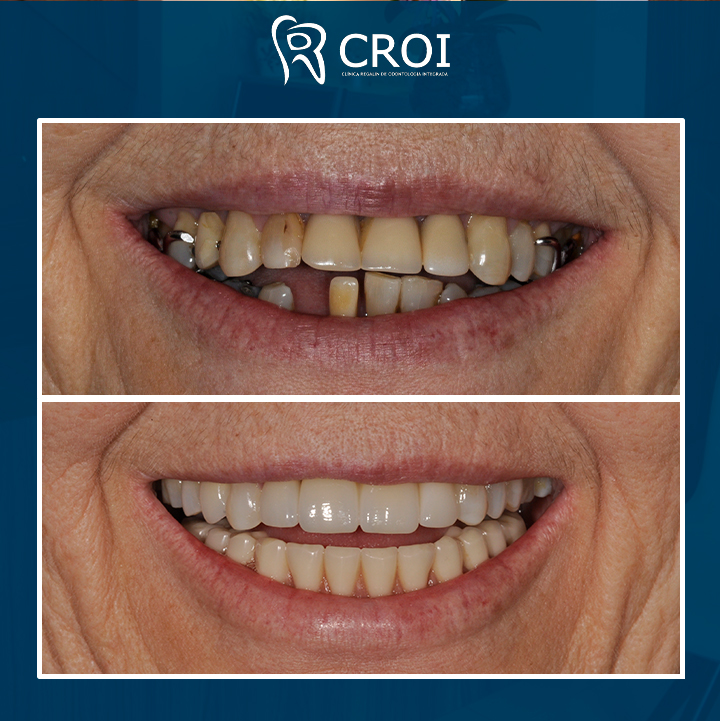 2023-12-05_22-00-05__GraphImage__C0fMFz3vTZR