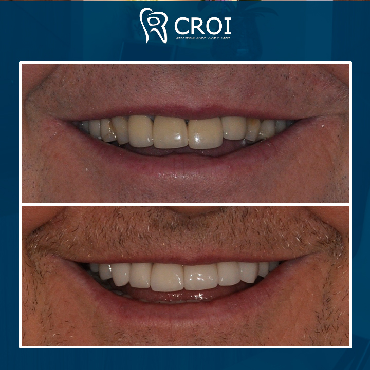 2024-01-13_13-00-50__GraphImage__C2CpYW0Ks_L