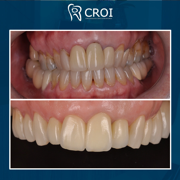 2024-02-15_23-01-20__GraphImage__C3YsVieNckE