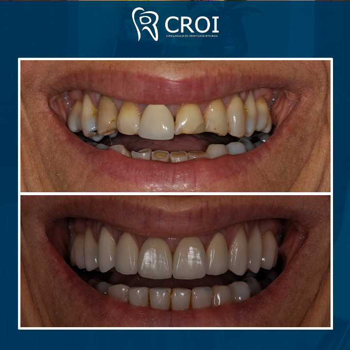 2024-02-22_23-00-56__GraphImage__C3qt2qMNCcA