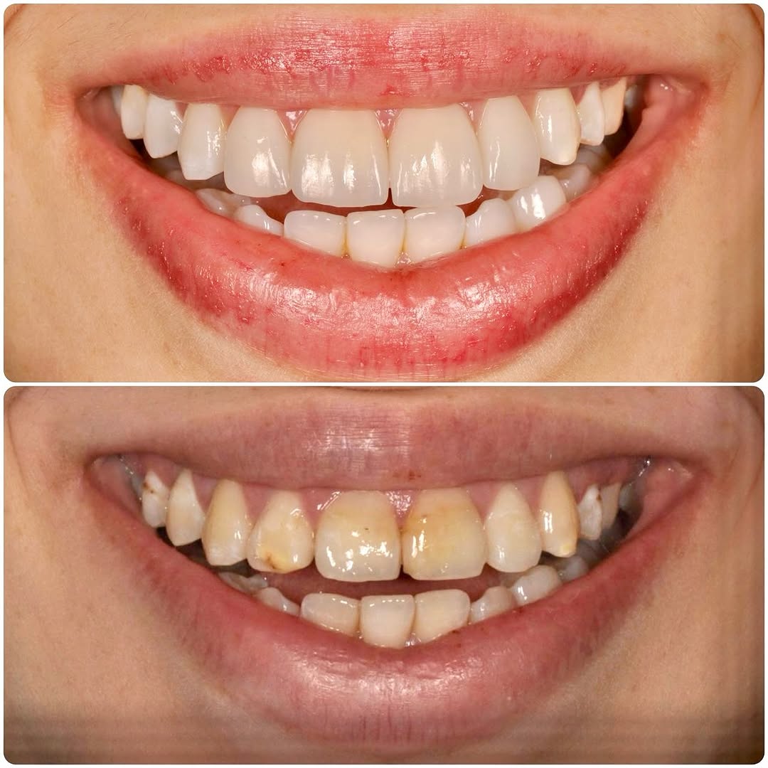 2025-02-12_22-23-42__GraphImage__DF_UlgDxsfq