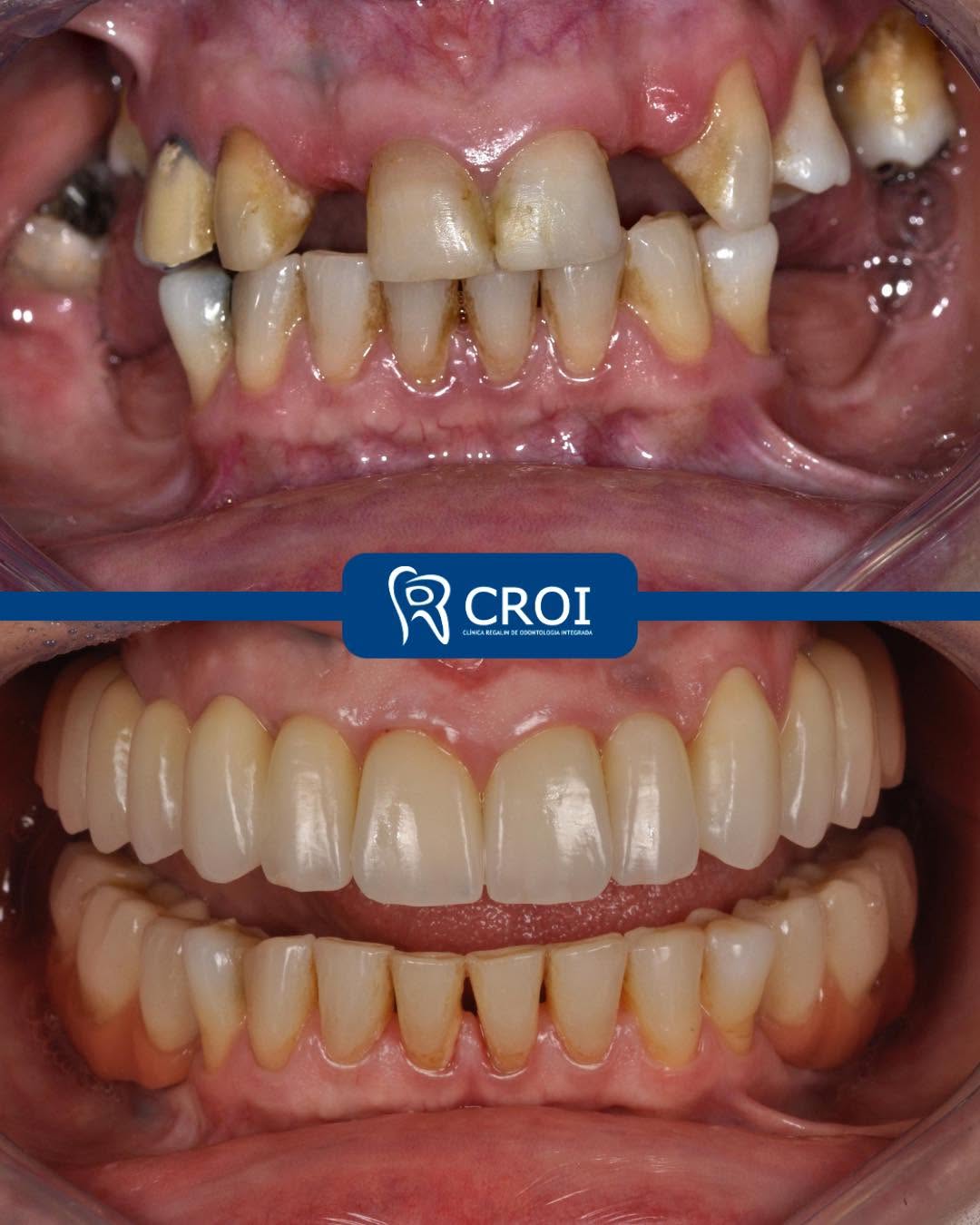 2025-05-15_22-00-42__GraphImage__DJsLFeKMghj