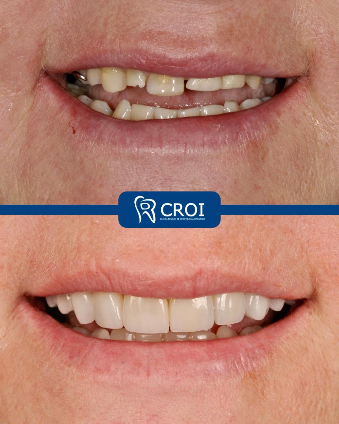 2025-06-19_22-30-30__GraphImage__DLGWUQhCkOz