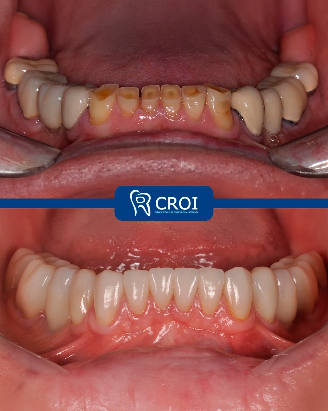 2025-07-04_22-00-46__GraphImage__DLs61rtBTbv