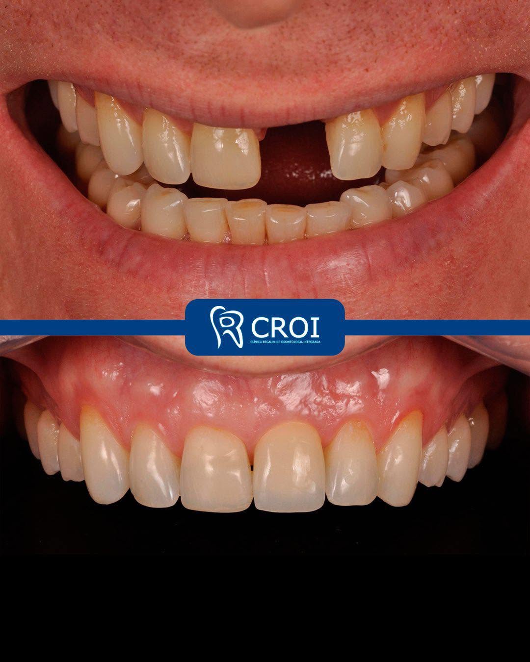 2025-07-11_11-01-54__GraphImage__DL9xALrO66F