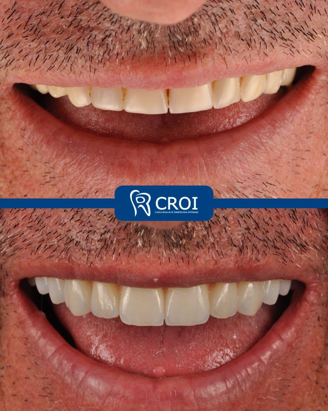 2025-07-15_23-01-48__GraphImage__DMJWkVNtFE1